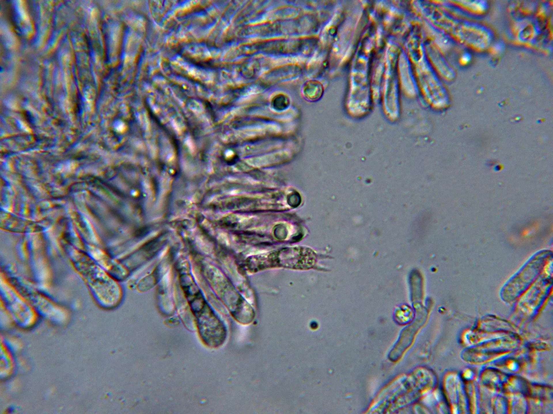 Microscopía de Resupinatus striatulus - 10 - Basidio tetraspórico-001